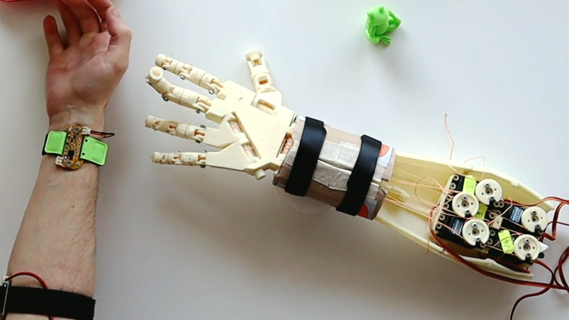 Robotic Arm Controlled With Muscle Movement via EMG…