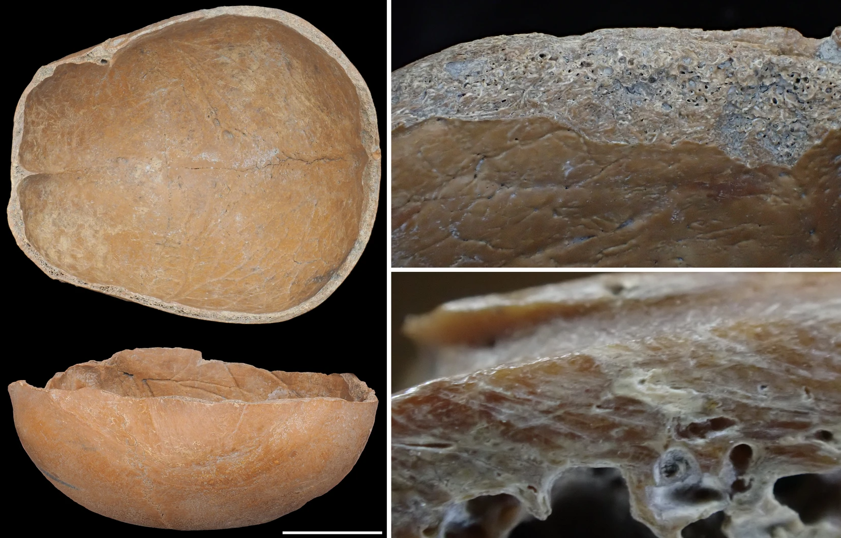 skull cups (left), closer look at the skull bone (right).