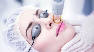 woman getting electrolysis on her face