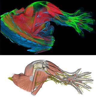 (Top) This is a limb from a transgenic, embryonic mouse, showing well established musculoskeletal and nervous systems. The limb is stained with a variety of techniques to differentiate muscle, tendon, bone, and nerve, and rendered into a three-dimensional
