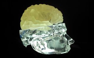 3D printed brain for deep brain stimulation (DBS) surgical planning.
