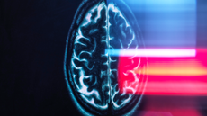 Refection of MRI brain scan on monitor display.