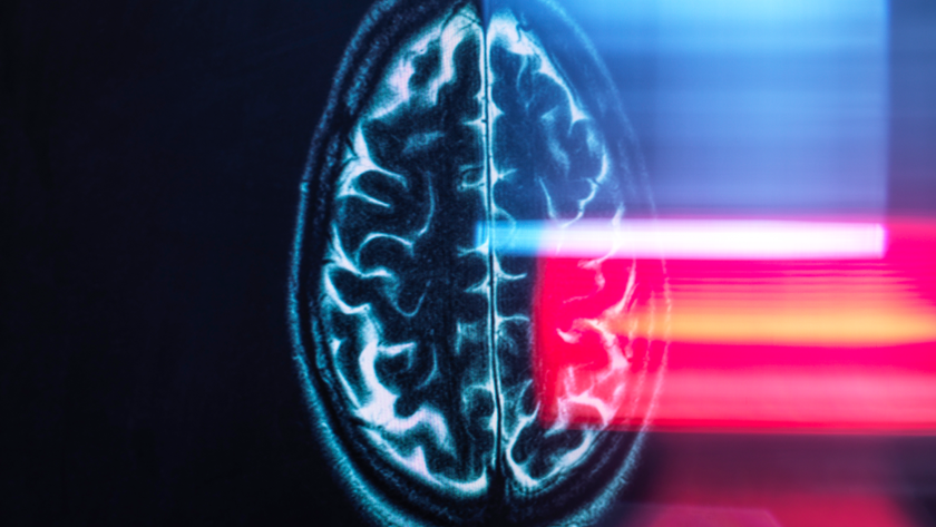 Refection of MRI brain scan on monitor display.