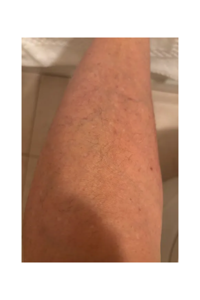 Domenica F., a ‘Marie Claire’ tester, tests the SmoothSkin Pure IPL Hair Removal Device
