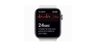 Die Apple Watch 4 hat bereits ein EKG.