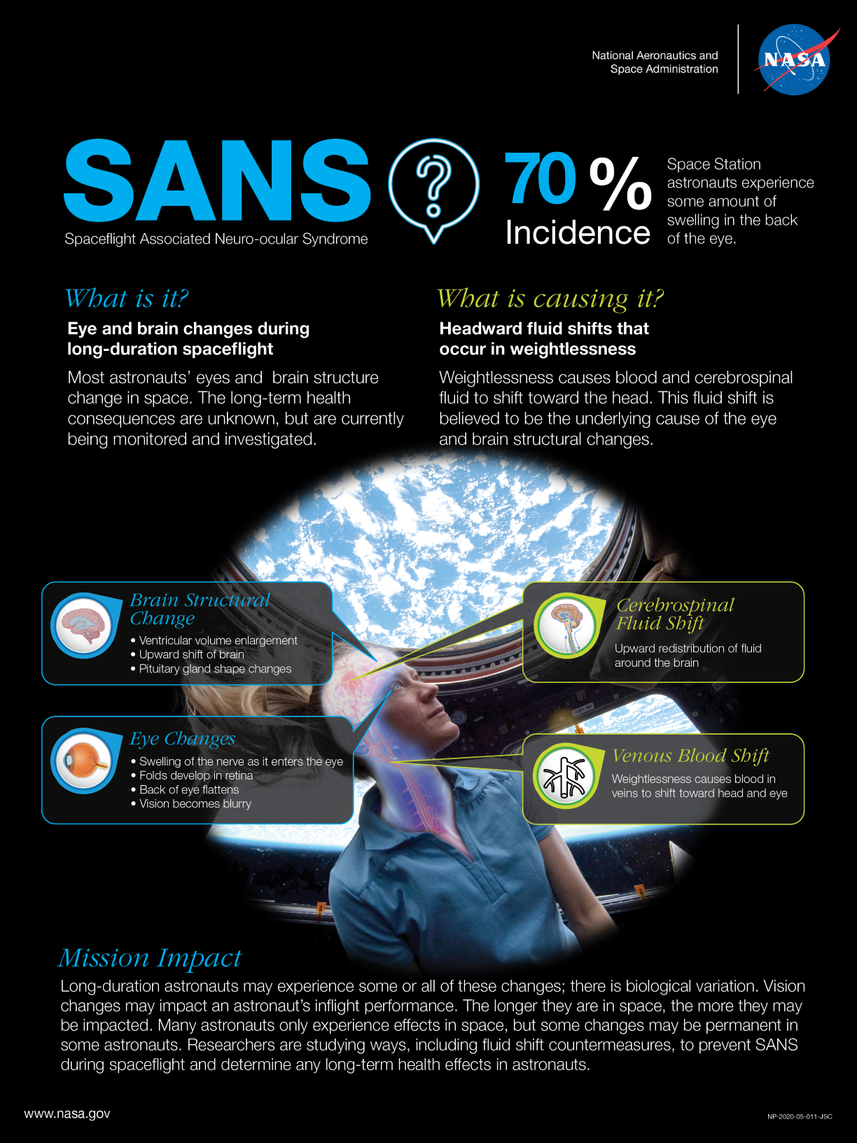 an infographic explaining the changes that happens to the human brain and eye when exposed to microgravity