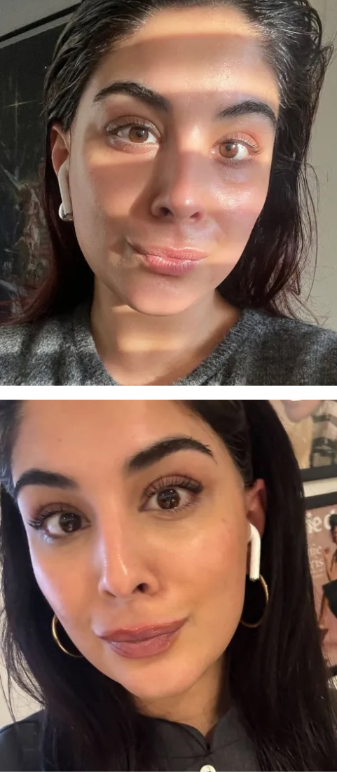 Hermes Foundation Review