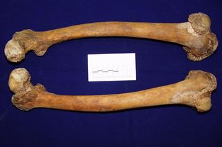 Femur bones