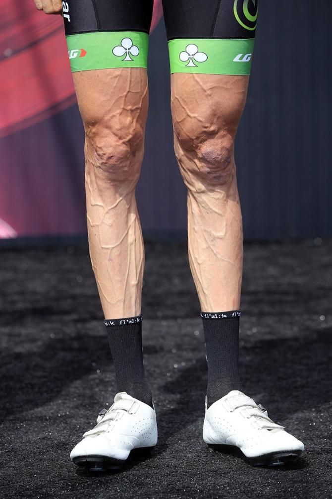 Now they are some veins