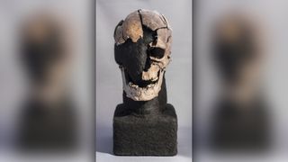 The reconstructed broken cranial remains of a man murdered by at least blows to the skull.