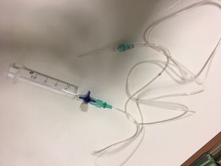 An image of the syringe-and-cannula apparatus that was put together to remove the boy's tongue from the bottle with an injection of air.