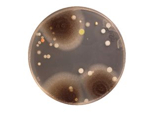 Belly button bacteria biodiversity sample no. 1155