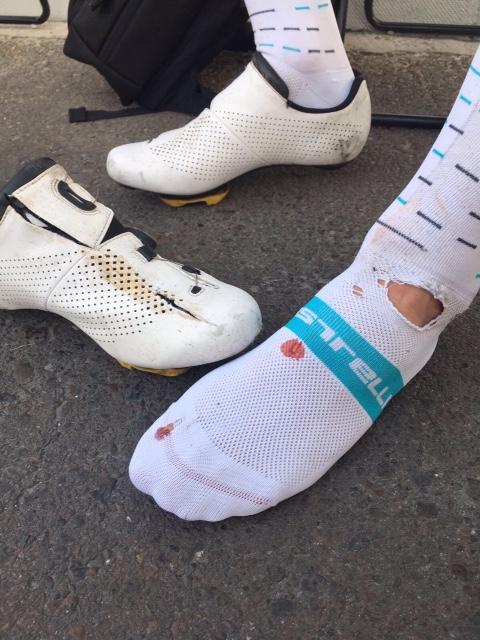 Owain Doull ended up with a slice to his sock after the crash