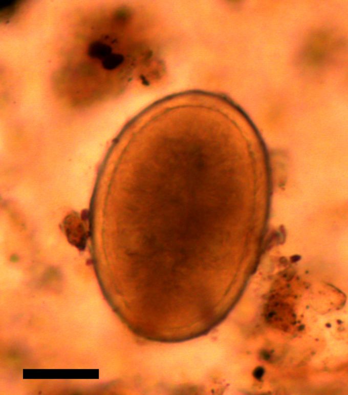 One of the roundword eggs found where King Richard III&#039;s intestines once lay. 