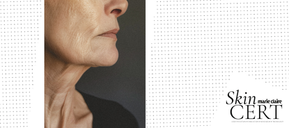 All Eyes on Inflammaging: The New Frontier in Skin Science