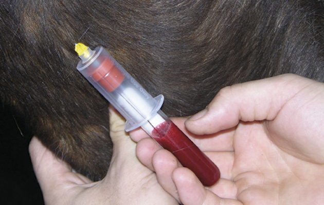 Blood test