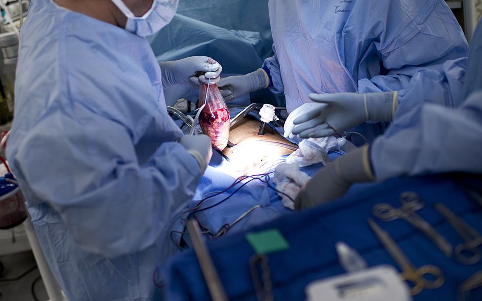 Kidney transplant