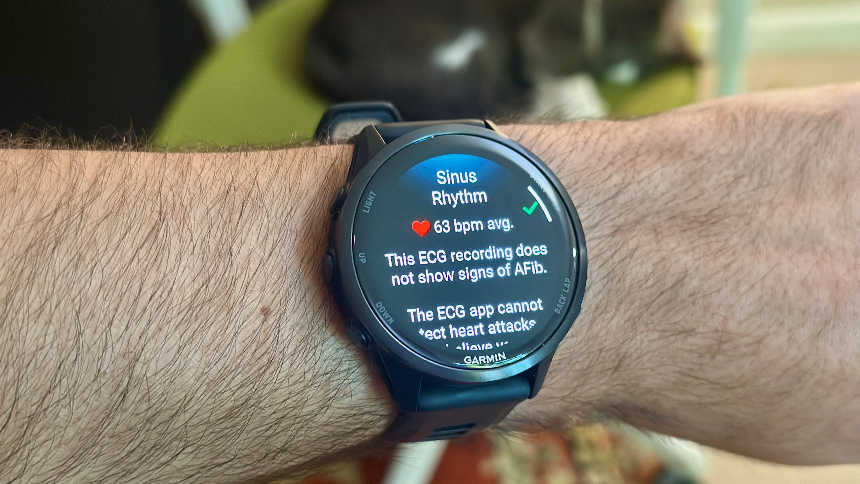 The Garmin Forerunner 970 showing an ECG reading with Sinus Rhythm data.
