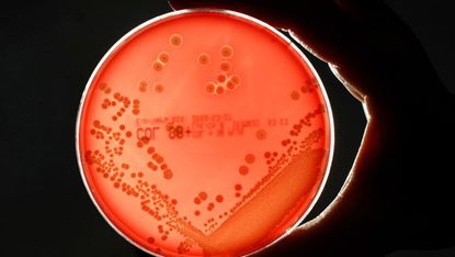 The MRSA bacteria strain in a petri dish