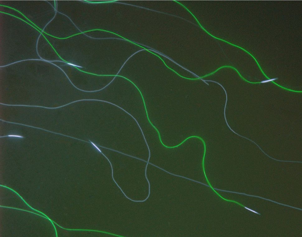 How a Jellyfish Protein Transformed Science Live Science