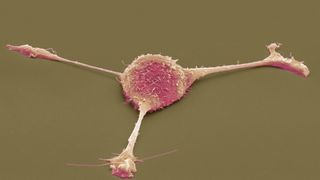 pink fibroblast on a gray background