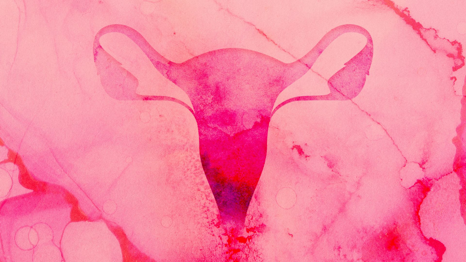 Testosterone use for menopause rises as access and safety questions persist