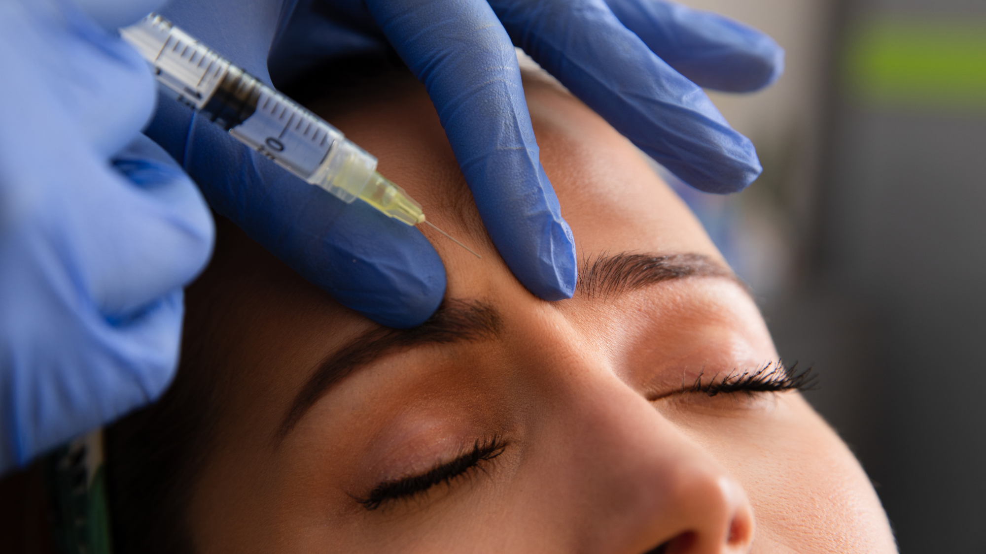woman getting botox injected into her forehead 