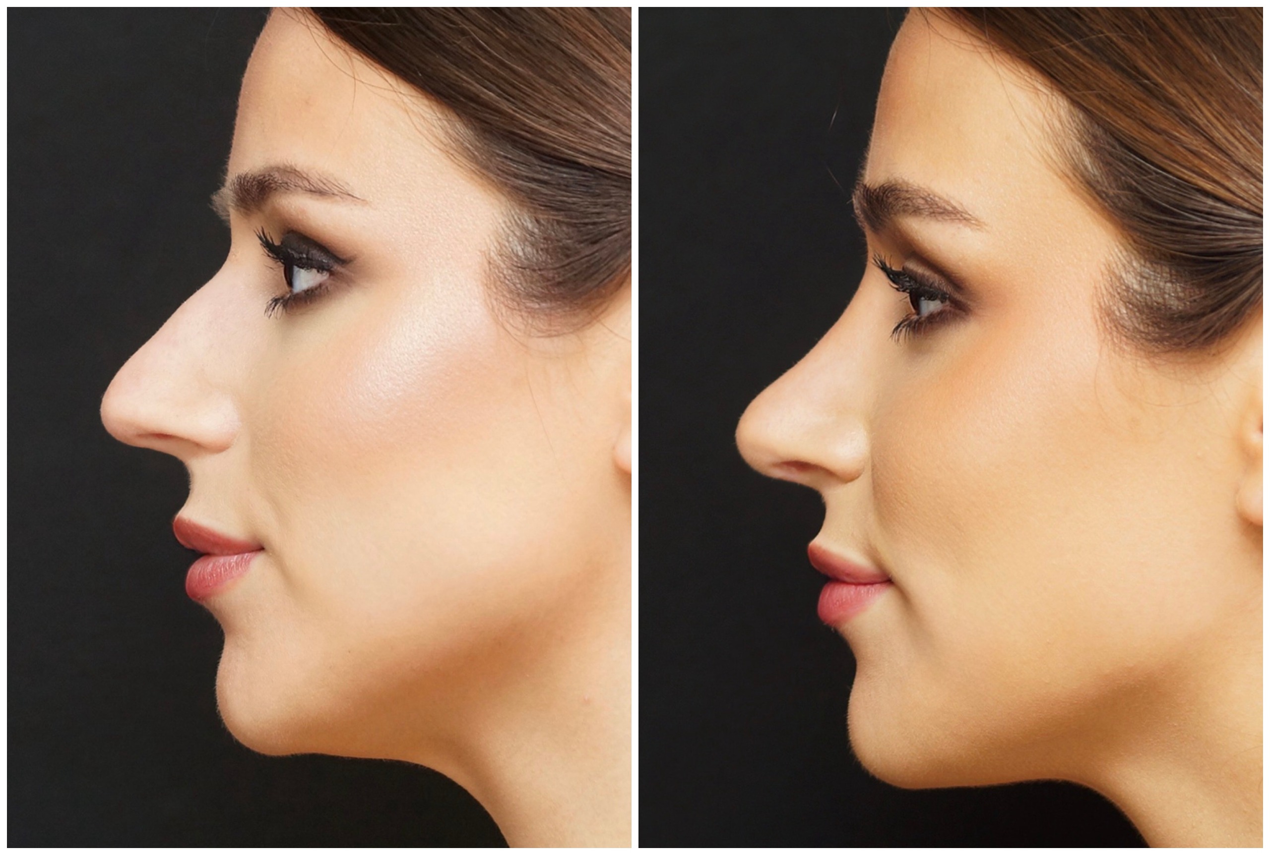 before and after