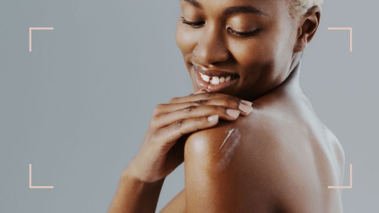 A woman applying cream on her upper arms in order to get rid of chicken skin keratosis pilaris 
