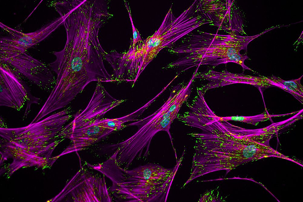 human stem cells, actin stress fibers, vinculin