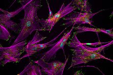 human stem cells, actin stress fibers, vinculin