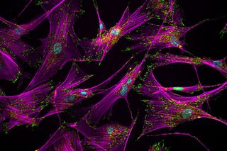 human stem cells, actin stress fibers, vinculin