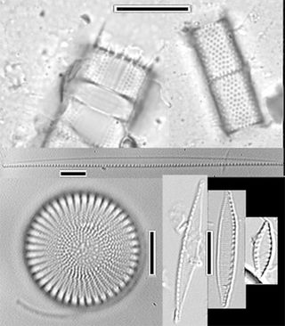 Examples of lake diatom cell walls that are found in East African lake deposits. The delicate shapes are formed of silica and allow scientists to identify the diatom species. Diatoms are sensitive to lake chemistry, so different species are good indicators of fresh or salty water, water depth and other factors. The scale bars are in microns.