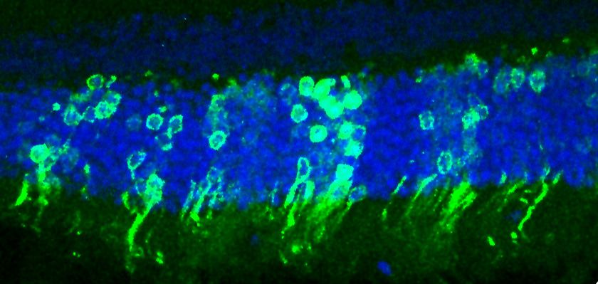 Image of the retinal cell layer, with green rod cells. 