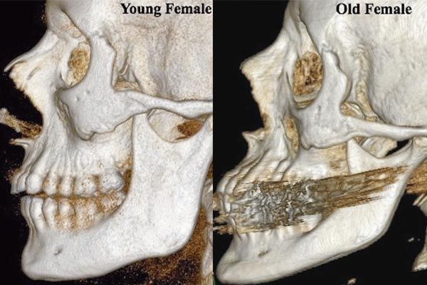 Your Facial Bone Structure Has a Big Influence on How People See