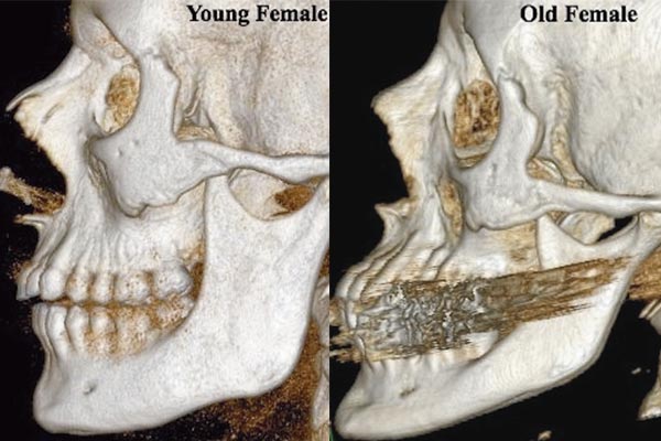 Our Face Bones Change Shape As We Age Live Science