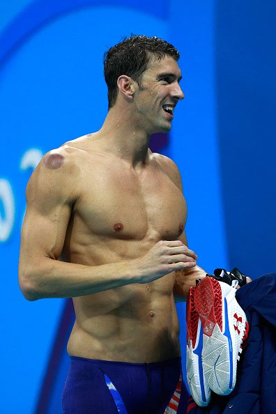 Michael Phelps and other swimmers sported red circles on their bodies, marks of a traditional Chinese practice known as 'cupping.'