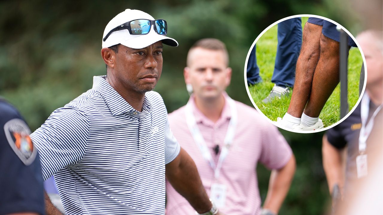 Main image of Tiger Woods at the US Junior Amateur with inset photo of his leg and the scars that remain from his 2021 car crash