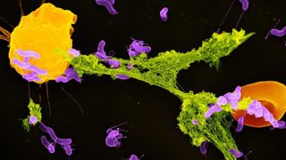 A neutrophil granulocyte (yellow) has ejected a NET (green) to capture bacteria (purple). A red blood cell (orange) is also trapped in the NET.