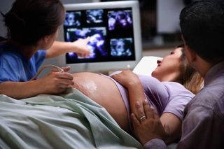 A doctor does an ultrasound on a pregnant woman to illustrate the ramzi theory