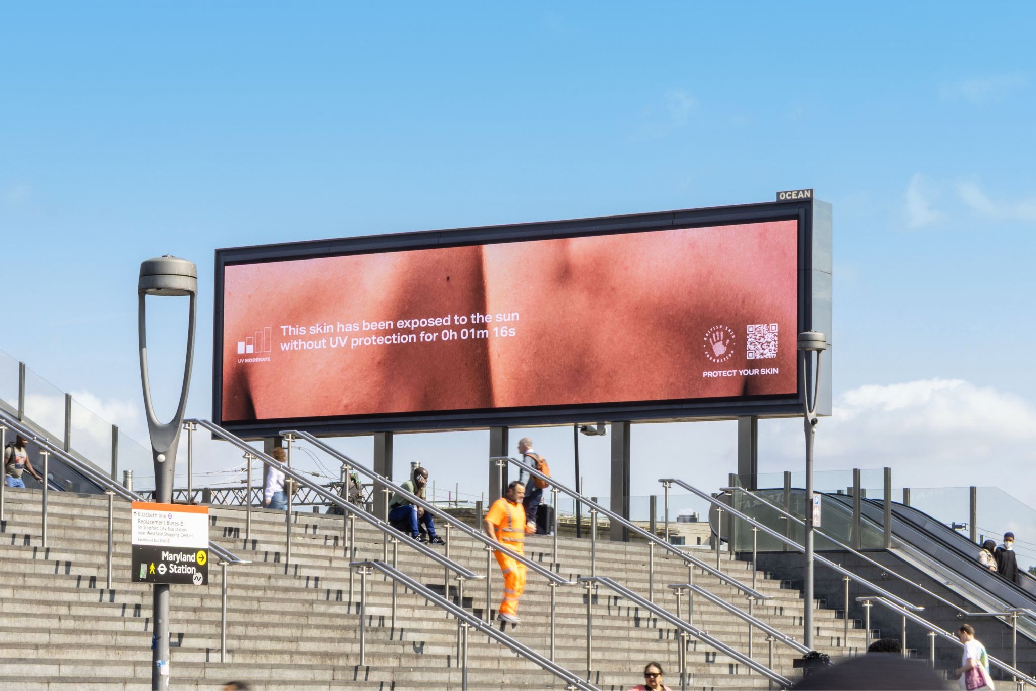 billboard showing sun damage to skin