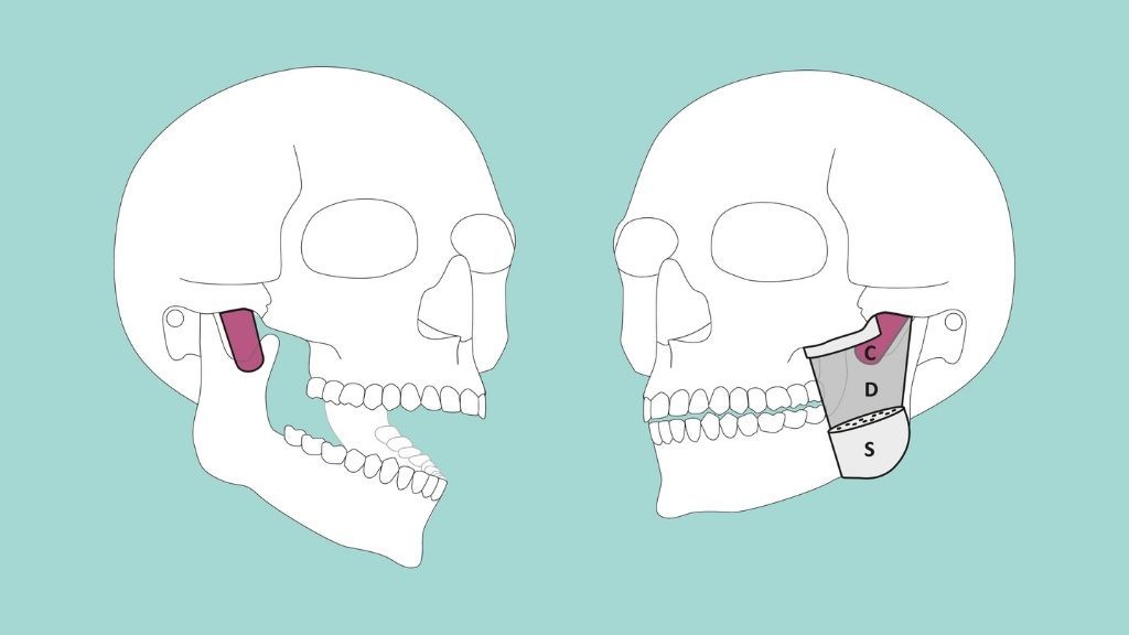 The newly discovered muscle layer runs from the back of the cheekbone to the anterior muscular process of the lower jaw. (S= superficial layer, D= deep layer, C= coronoid layer)