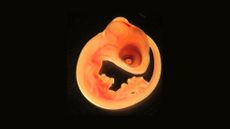 Lizard embryo.