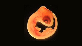 Lizard embryo.