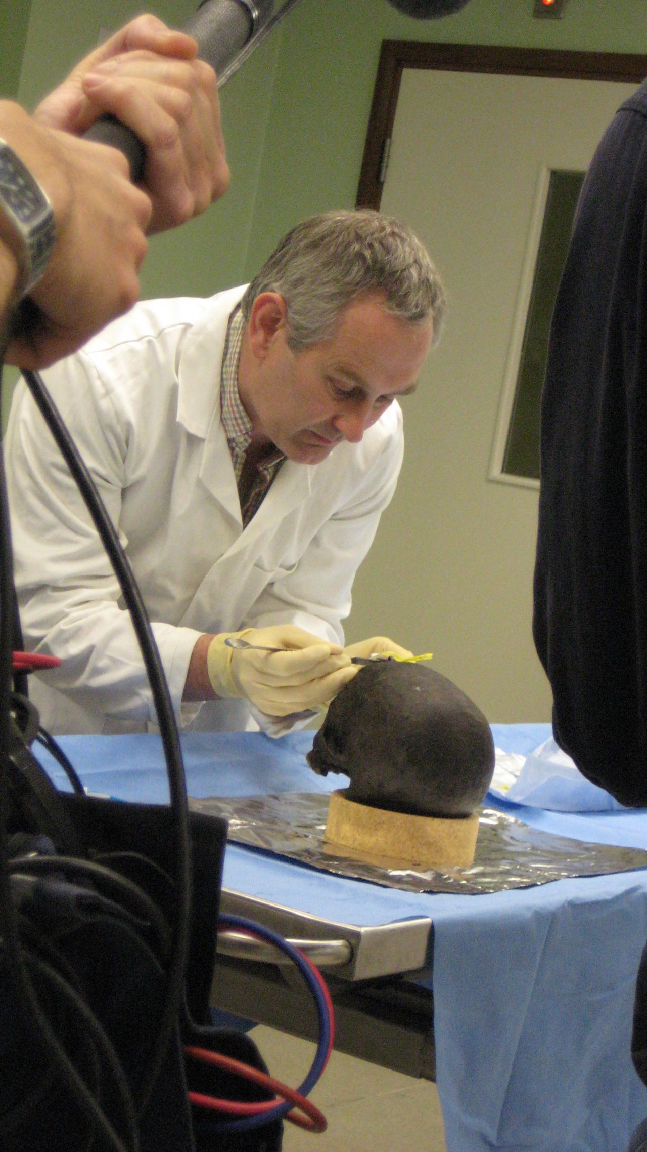 A researcher examines the Iron Age brain found in Heslington, England.