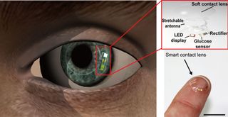 contact lens, glucose monitor 