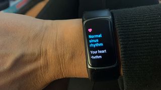 Fitbit Charge 5 ECG reading results