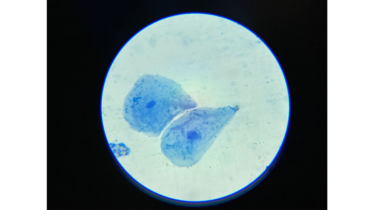 Swift SW380T microscope image of organelles in cheek cells