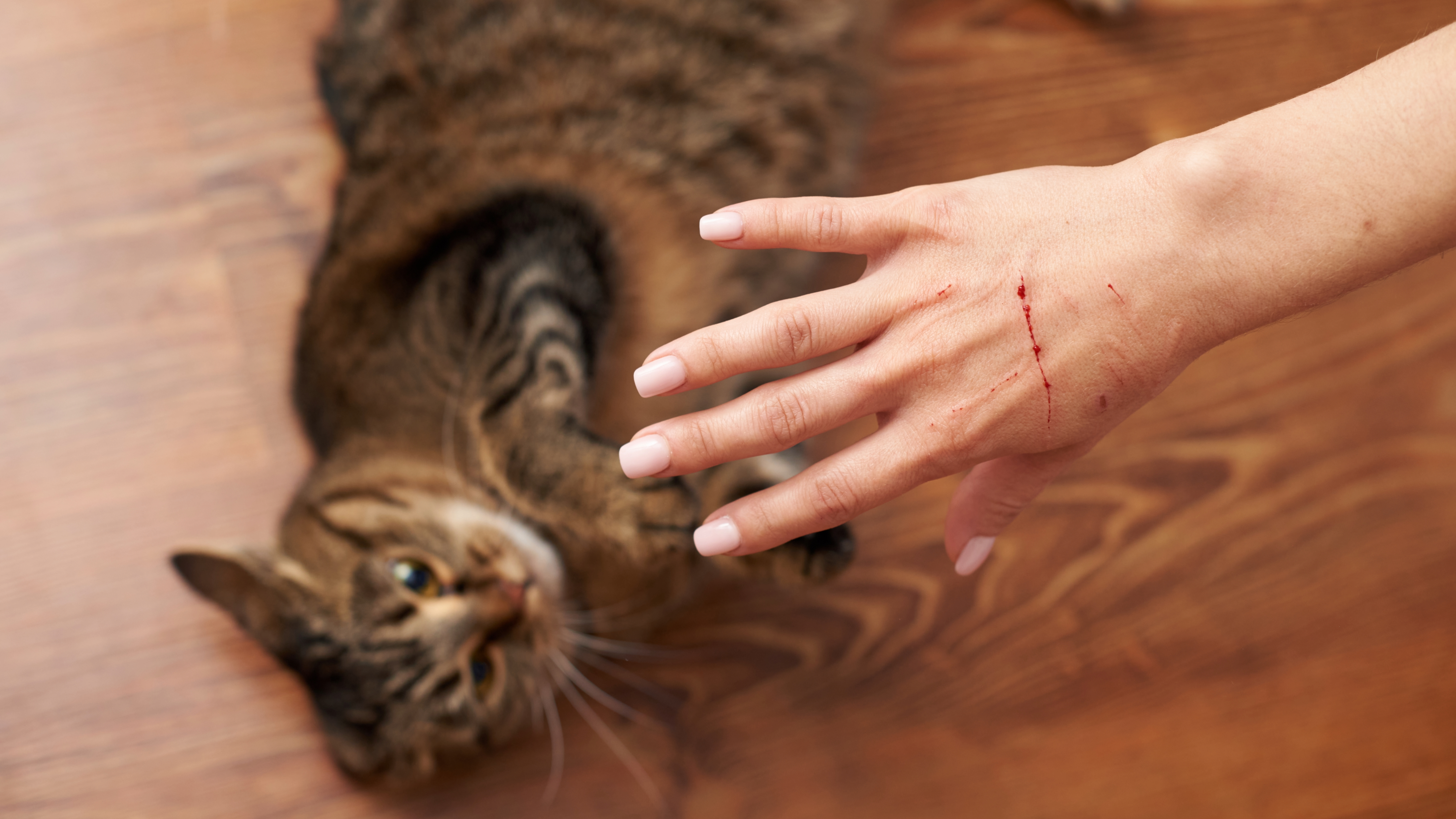 Person holding up hand with cat scratch