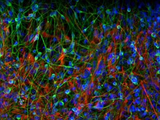 The study of induced pluripotent stem (iPS) cell-derived neurons is a promising new approach to understanding the molecular and cellular underpinnings of schizophrenia, bipolar disorder, and other psychiatric diseases. Researchers are investigating the di